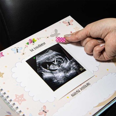 Hamilelik Ve Anne Bebek Günlüğü – Anı Defteri